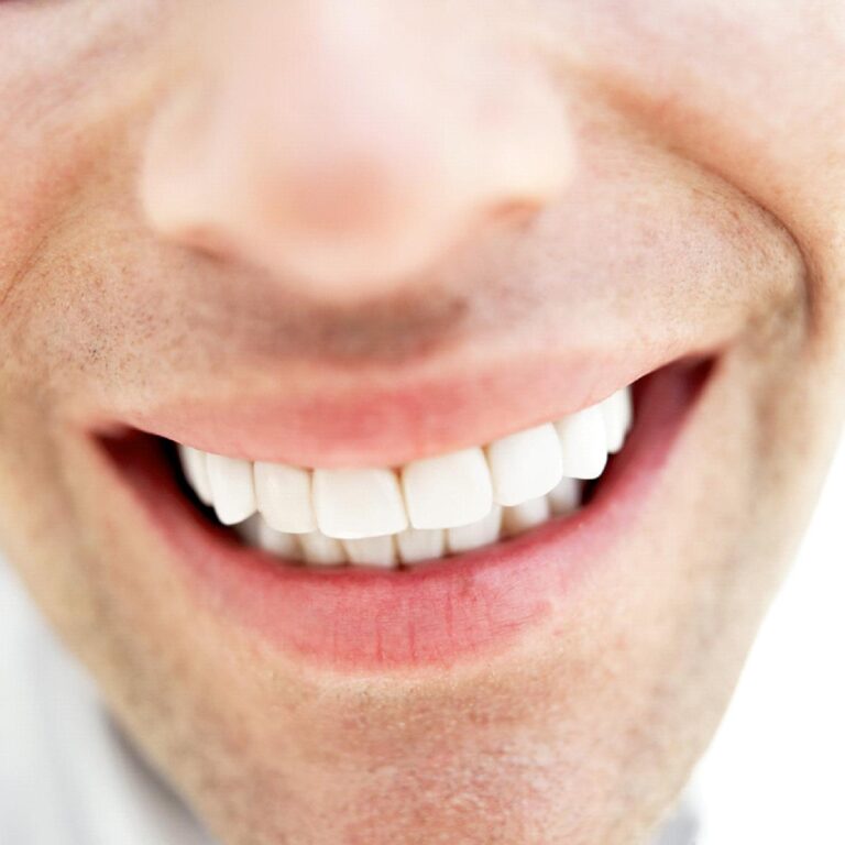 Management Lesson from My Teeth
